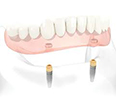 Paro-Gembloux - La parodontologie et l'implantologie.