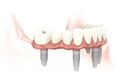 Paro-Gembloux - La parodontologie et l'implantologie.